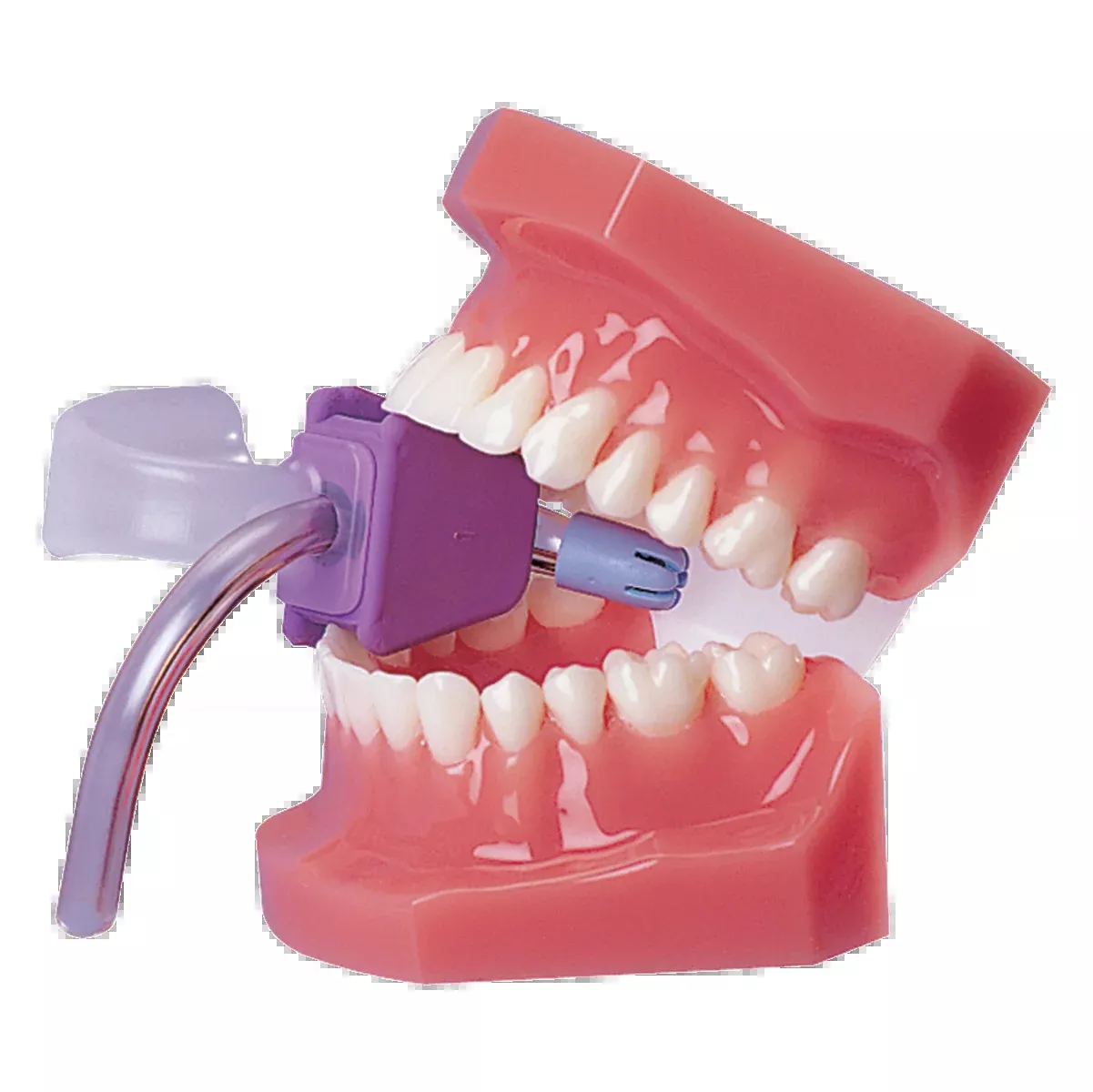 Wraparound Mouth Prop With SE Tip